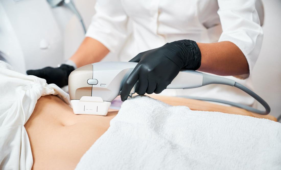 cryo body sculpting