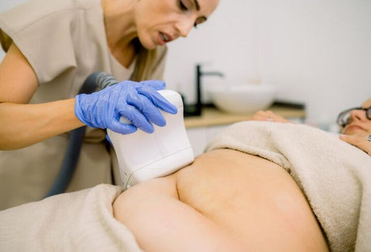 fat freezing